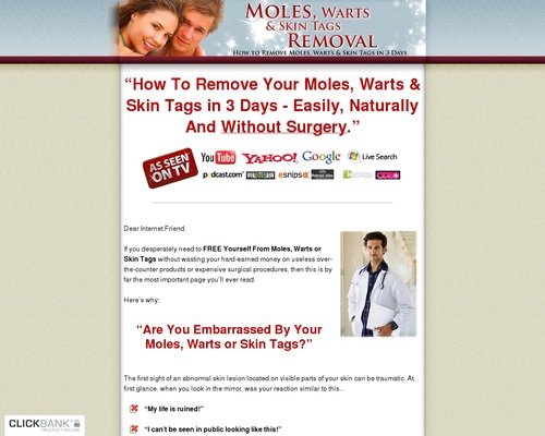 Moles, Warts & Skin Tags Removal - How To Safely & Permanently Remove ...